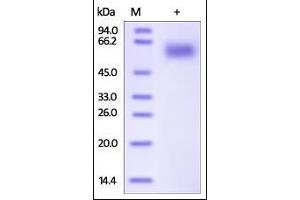 Human IL-1 RAcP, His Tag on SDS-PAGE under reducing (R) condition.