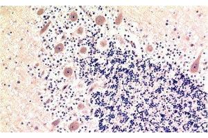 Immunohistochemistry of paraffin-embedded Human brain tissue using MAP1LC3B Monoclonal Antibody at dilution of 1:200. (LC3B anticorps)