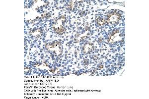 Rabbit Anti-CEACAM6 Antibody  Paraffin Embedded Tissue: Human Lung Cellular Data: Alveolar cells Antibody Concentration: 4. (CEACAM6 anticorps  (Middle Region))