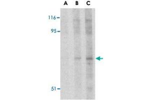 Western blot analysis of RPS6KA1 in Jurkat cell lysate with RPS6KA1 polyclonal antibody  at (A) 2. (RPS6KA1 anticorps  (N-Term))