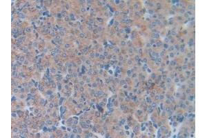 Detection of LCN5 in Mouse Ovary Tissue using Polyclonal Antibody to Lipocalin 5 (LCN5) (LCN5 anticorps  (AA 28-187))