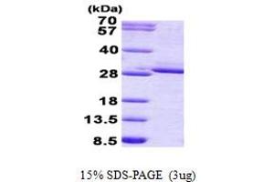 Fibroblast Growth Factor 17 (FGF17) (AA 23-216) protein (His tag)