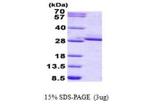 SDS-PAGE (SDS) image for Fibroblast Growth Factor 17 (FGF17) (AA 23-216) protein (His tag) (ABIN5852968) (FGF17 Protein (AA 23-216) (His tag))
