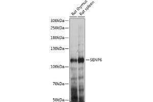 Western blot analysis of extracts of various cell lines, using SENP6 antibody (ABIN7270635) at 1:1000 dilution.