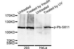 Western Blotting (WB) image for anti-Retinoblastoma 1 (RB1) (pSer811) antibody (ABIN3023610) (Retinoblastoma 1 anticorps  (pSer811))