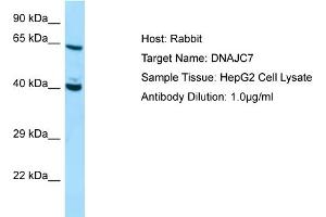 Western Blotting (WB) image for anti-DnaJ (Hsp40) Homolog, Subfamily C, Member 7 (DNAJC7) (C-Term) antibody (ABIN2774429)