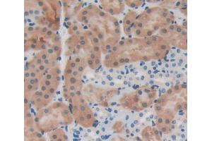 Used in DAB staining on fromalin fixed paraffin- embedded Kidney tissue (IL12RB1 anticorps  (AA 197-348))