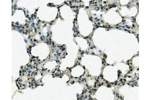 IHC analysis of REC8 using anti-REC8 antibody (ABIN7599473). (REC8 anticorps  (AA 1-547))