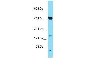Host: Rabbit  Target Name: Ndufa3  Sample Tissue: Mouse Heart lysates  Antibody Dilution: 1.