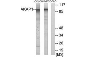 Western blot analysis of extracts from HuvEc/COLO cells, using AKAP1 Antibody.