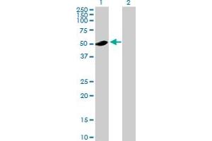 Western Blot analysis of ADSL expression in transfected 293T cell line by ADSL MaxPab polyclonal antibody.
