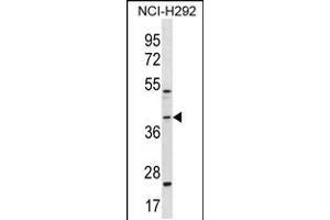 Western blot analysis in NCI-H292 cell line lysates (35ug/lane). (GIPC2 anticorps  (C-Term))