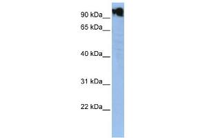 WB Suggested Anti-ZFY Antibody Titration:  0.