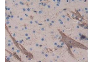 DAB staining on IHC-P; Samples: Mouse Cerebrum Tissue