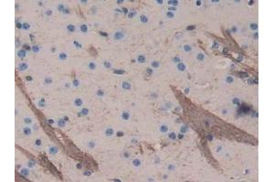 DAB staining on IHC-P; Samples: Mouse Cerebrum Tissue (Aggrecan anticorps  (AA 587-684))