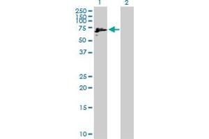 Western Blot analysis of IMPDH2 expression in transfected 293T cell line by IMPDH2 MaxPab polyclonal antibody. (IMPDH2 anticorps  (AA 1-514))