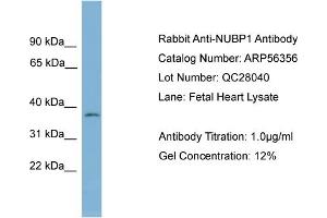 WB Suggested Anti-NUBP1  Antibody Titration: 0. (NUBP1 anticorps  (Middle Region))