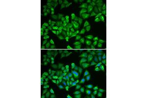 Immunofluorescence analysis of A549 cells using FTL antibody (ABIN5970889). (FTL anticorps)