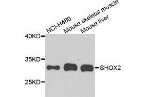 Western blot analysis of extract of various cells, using SHOX2 antibody. (SHOX2 anticorps)