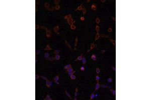 Immunofluorescence analysis of NIH/3T3 cells using LAMP1 antibody.