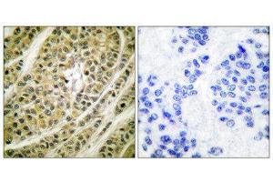 Immunohistochemistry (IHC) image for anti-Histone Deacetylase 5 (HDAC5) (C-Term) antibody (ABIN1848600)