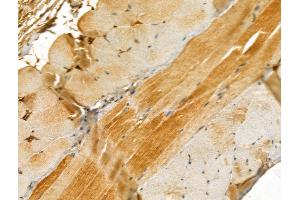 ABIN6261614 and ABIN6273044 at 1/100 staining Mouse skin tissue by IHC-P. (ETFB anticorps  (Internal Region))