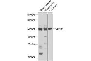 Western blot analysis of extracts of various cell lines, using CLPTM1 Antibody (ABIN6128987, ABIN6138748, ABIN6138749 and ABIN6223577) at 1:1000 dilution. (CLPTM1 anticorps  (AA 1-280))