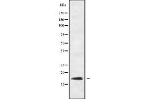 Western blot analysis of RGS21 using HeLa whole cell lysates (RGS21 anticorps  (N-Term))