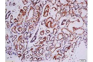Formalin-fixed and paraffin embedded human kidney labeled with Rabbit Anti-RSK2(Tyr529) Polyclonal Antibody, Unconjugated (ABIN745283) at 1:200 followed by conjugation to the secondary antibody and DAB staining (RPS6KA3 anticorps  (pTyr529))