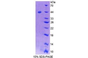SDS-PAGE analysis of Human SYCN Protein. (SYCN Protéine)