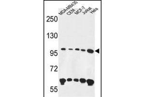 ANKFY1 anticorps  (C-Term)