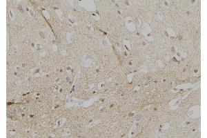 ABIN6274545 at 1/100 staining Human brain tissue by IHC-P. (FOXD3 anticorps  (Internal Region))