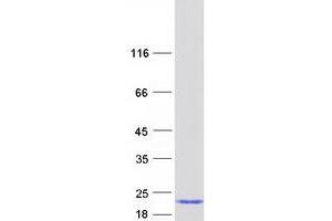 Validation with Western Blot
