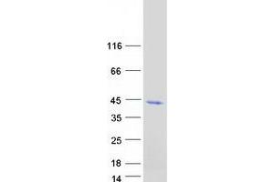 Validation with Western Blot