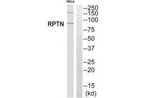 Western blot analysis of extracts from HeLa cells, using RPTN antibody. (Repetin anticorps  (C-Term))