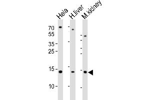 Western blot analysis of lysates from Hela cell line, human liver and mouse kidney tissue lysate(from left to right), using CDA Antibody (Center) (ABIN389394 and ABIN2839486). (CDA anticorps  (AA 51-83))