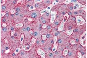 anti-Low Density Lipoprotein Receptor-Related Protein 1 (LRP1) antibody