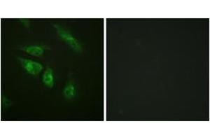 Immunofluorescence analysis of HeLa cells, using NFAT3 (Ab-676) Antibody. (NFATC4 anticorps  (AA 642-691))
