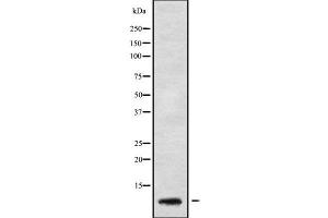 Western blot analysis GNG5 using HeLa whole cell lysates (GNG5 anticorps  (Internal Region))