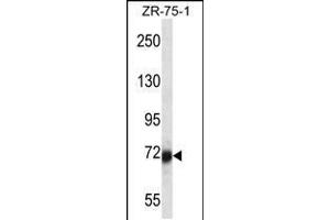 Western blot analysis in ZR-75-1 cell line lysates (35ug/lane). (SP100 anticorps  (N-Term))