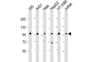 All lanes : Anti-DDX21 Antibody (N-term) at 1:2000 dilution Lane 1: 293 whole cell lysate Lane 2: A431 whole cell lysate Lane 3: Hela whole cell lysate Lane 4: HepG2 whole cell lysate Lane 5: HT-1080 whole cell lysate Lane 6: Jurkat whole cell lysate Lysates/proteins at 20 μg per lane. (DDX21 anticorps  (N-Term))