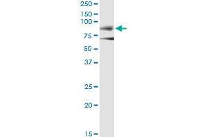 Immunoprecipitation of DMD transfected lysate using anti-DMD monoclonal antibody and Protein A Magnetic Bead , and immunoblotted with DMD MaxPab rabbit polyclonal antibody.