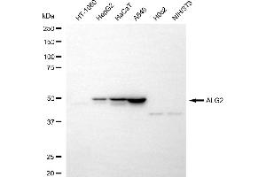 Western blotting analysis using ALG2 antibody (ABIN7797663). (ALG2 anticorps)