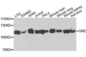 Western blot analysis of extracts of various cell lines, using GNE antibody (ABIN5996449) at 1/1000 dilution. (GNE anticorps)