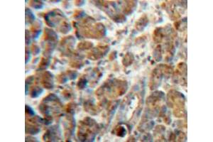 Used in DAB staining on fromalin fixed paraffin-embedded Pancreas tissue (NPTX2 anticorps  (AA 111-367))