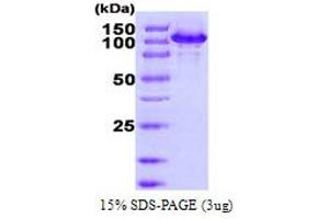 Heat Shock 105kDa/110kDa Protein 1 (HSPH1) (AA 1-858) protein (His tag)