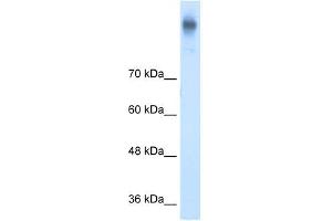 Western Blot showing SLC12A2 antibody used at a concentration of 1-2 ug/ml to detect its target protein. (SLC12A2 anticorps)