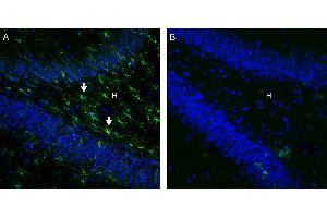 Expression of GPR43/FFAR2 in rat hippocampus. (FFAR2 anticorps  (C-Term, Intracellular))
