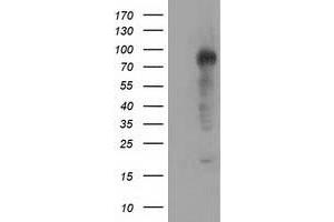 HEK293T cells were transfected with the pCMV6-ENTRY control (Left lane) or pCMV6-ENTRY TACC3 (Right lane) cDNA for 48 hrs and lysed. (TACC3 anticorps)