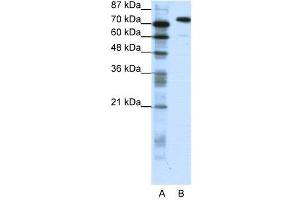 SATB1 anticorps  (C-Term)